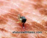 Honeybee stinger in freckled skin